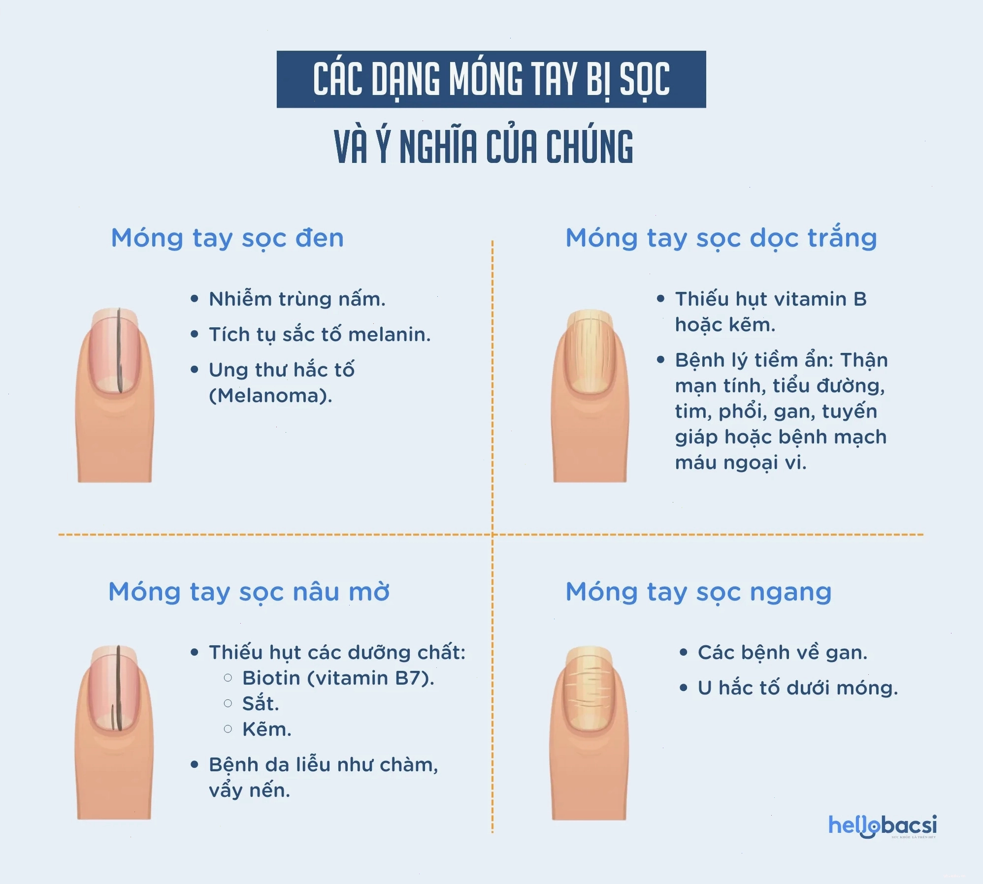 Các dạng biến đổi sắc tố trên móng tay