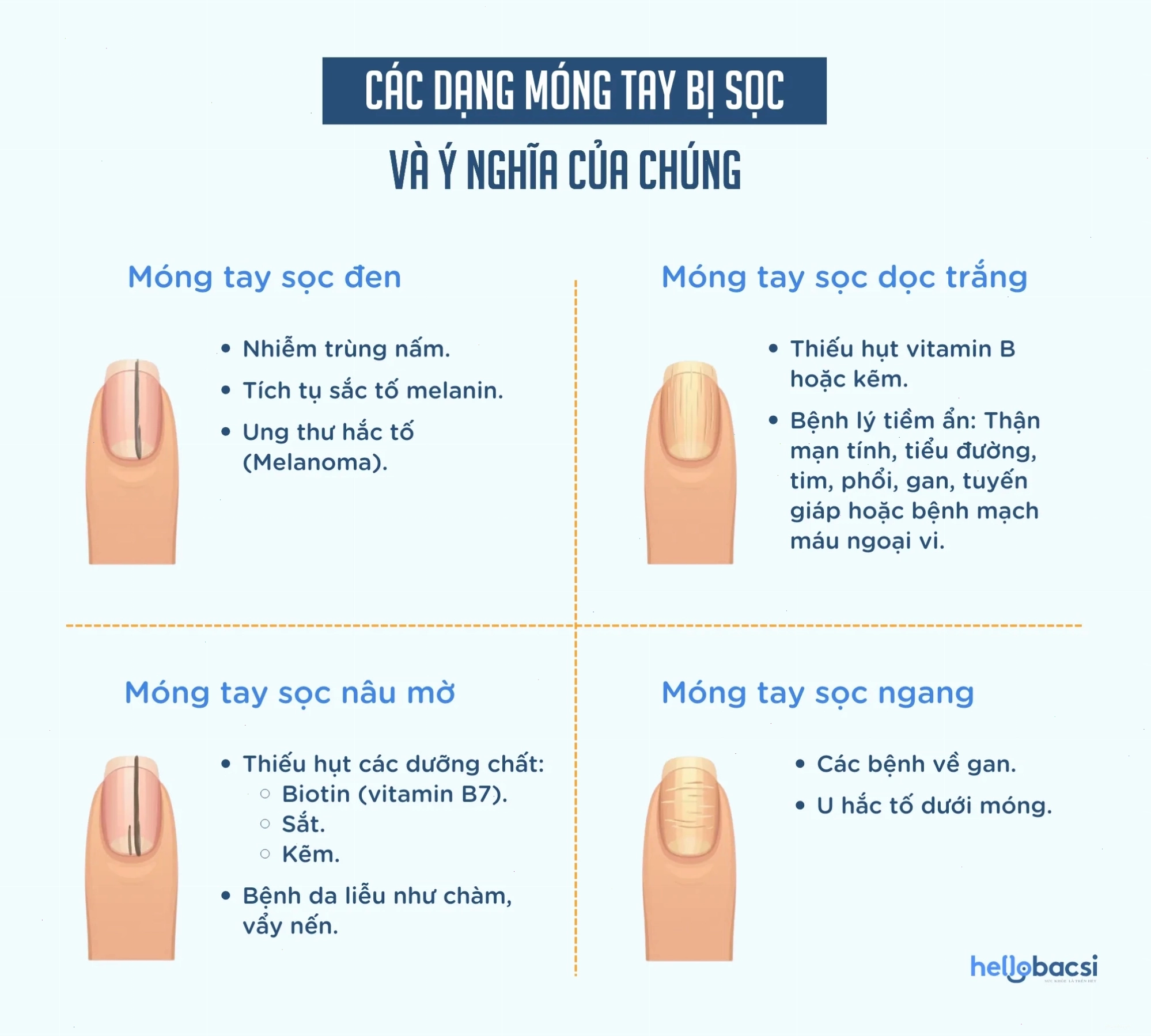 Các dạng móng tay bị sọc phổ biến