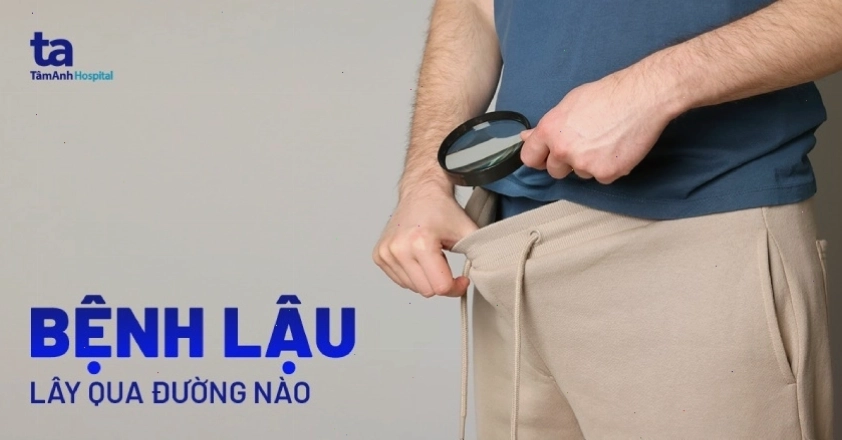 Các đường lây truyền bệnh lậu