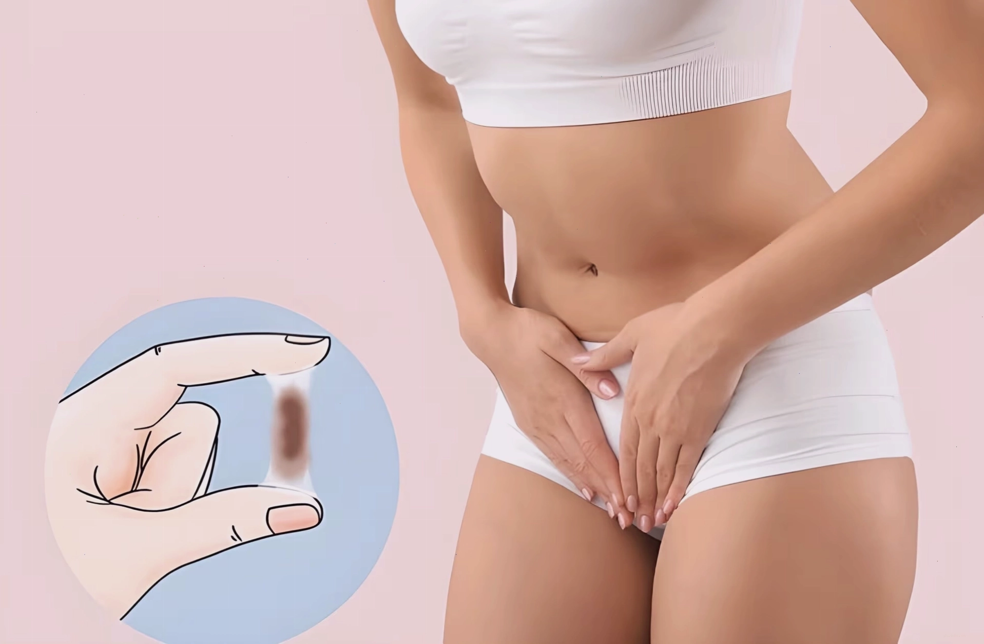 Các loại bệnh phụ khoa liên quan khí hư