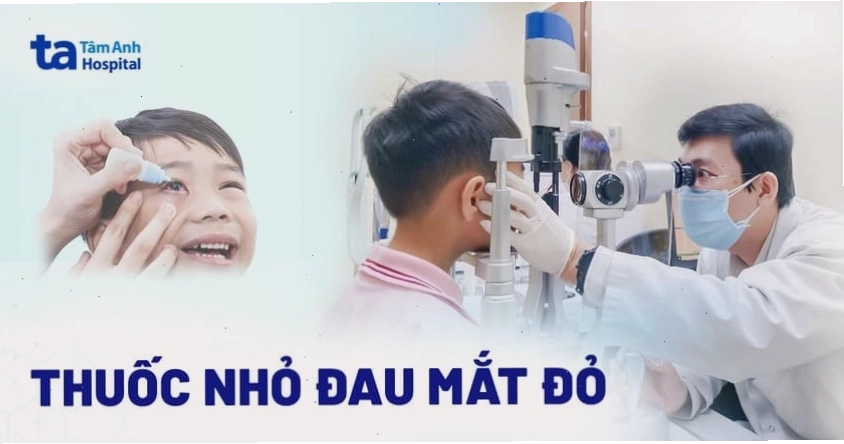 Các loại thuốc nhỏ mắt hỗ trợ điều trị