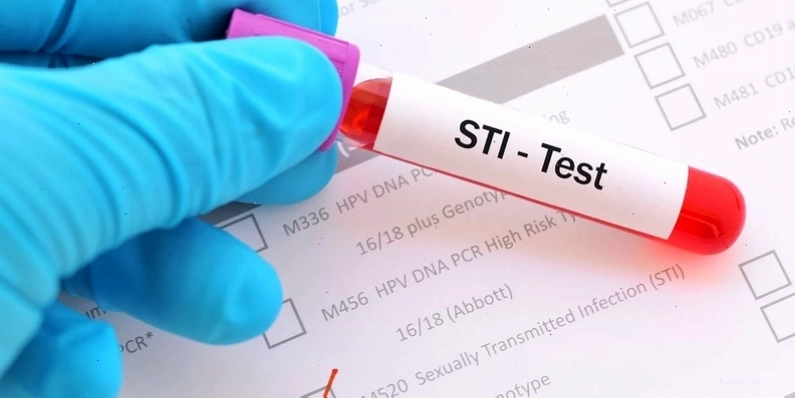 Các loại xét nghiệm STI phổ biến hiện nay