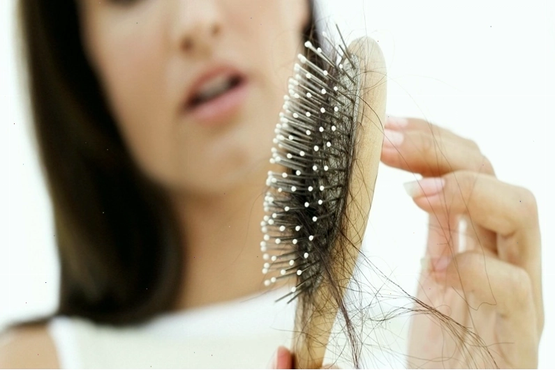 Các mảng tóc rụng dần lộ rõ da đầu ở phụ nữ