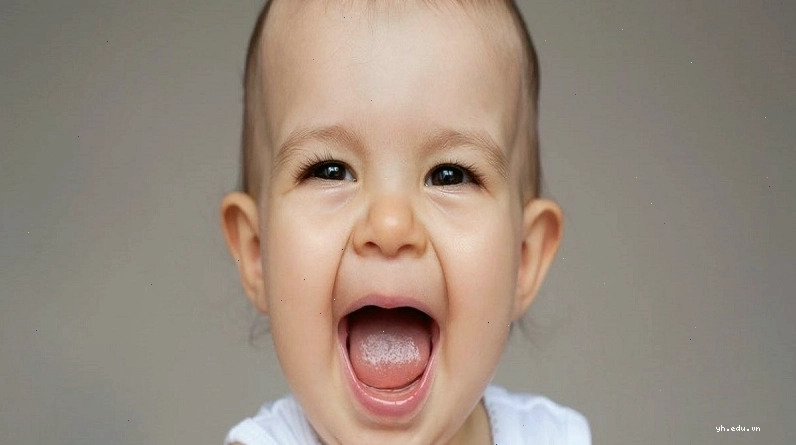 Các mức độ của bệnh được phân chia dựa vào chiều dài thắng lưỡi