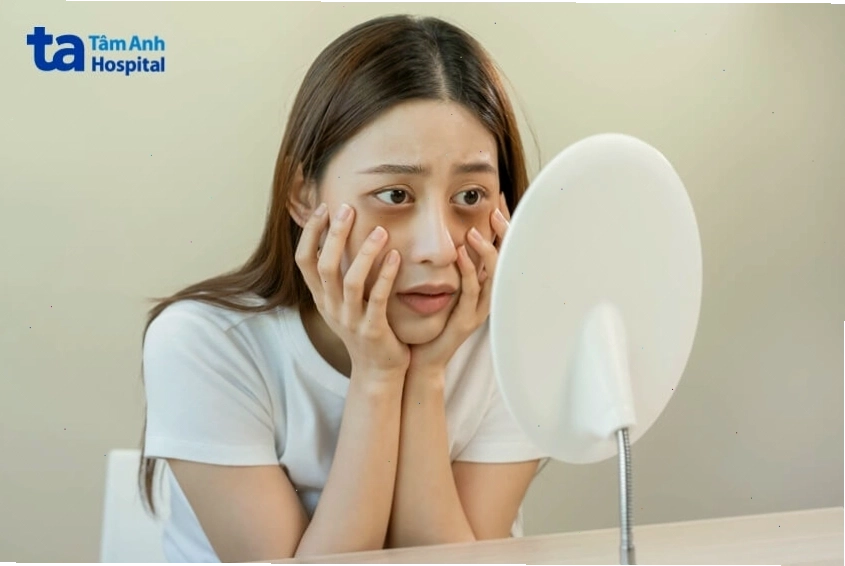Các nguyên nhân chính gây buồn ngủ nhiều