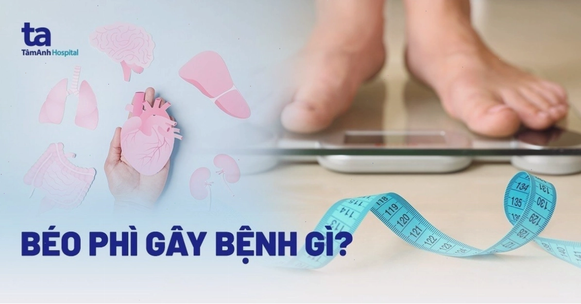 Các nhóm bệnh lý liên quan đến tình trạng béo phì