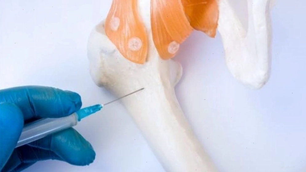 Các phương pháp điều trị đa u tủy xương