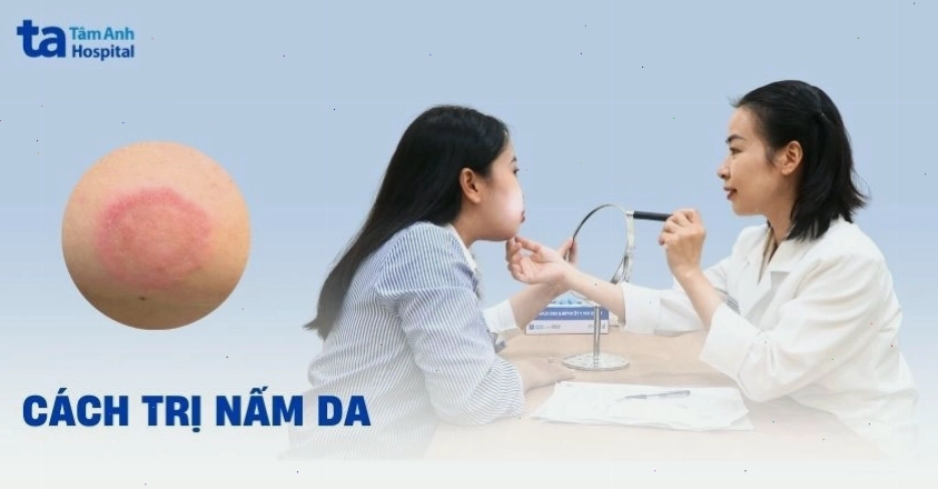 Các phương pháp điều trị nấm da an toàn và hiệu quả