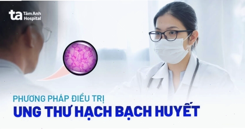 Các phương pháp điều trị ung thư hạch hiện đại tại bệnh viện