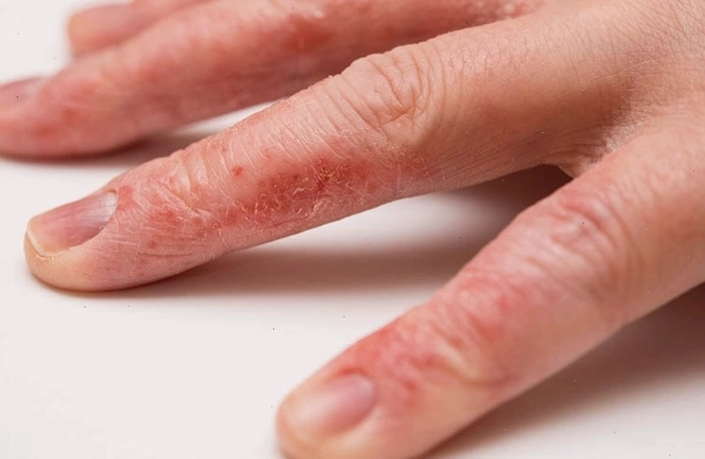 Các phương pháp hỗ trợ điều trị bệnh