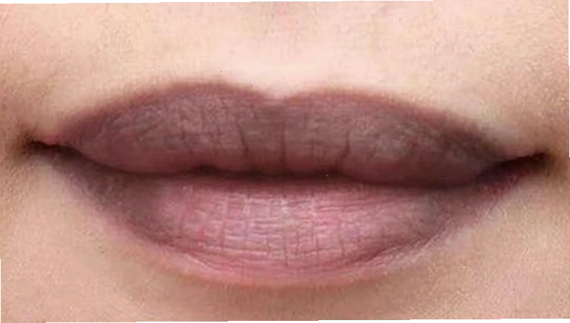 Các sắc thái môi khác nhau và bệnh lý