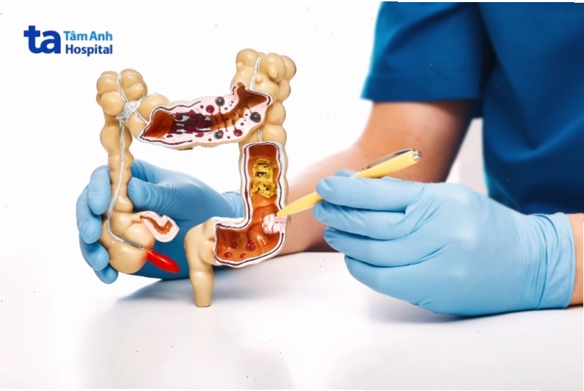 Các thực phẩm tốt cho hệ tiêu hóa