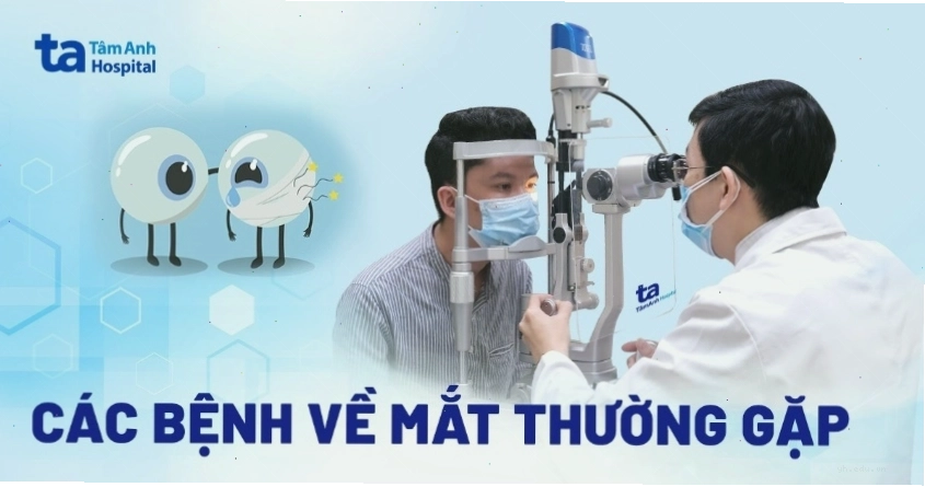 Các thực phẩm tốt cho mắt