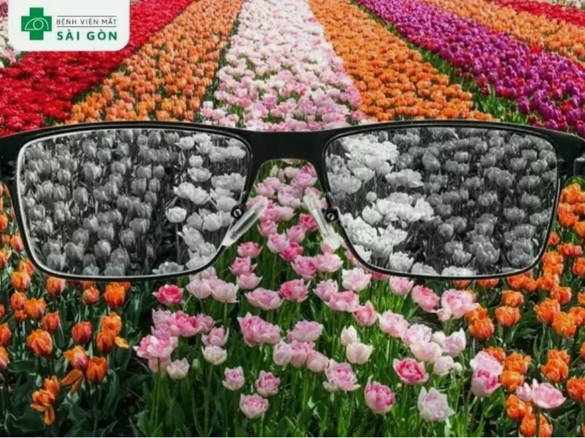 Các triệu chứng điển hình của tình trạng không phân biệt được màu sắc