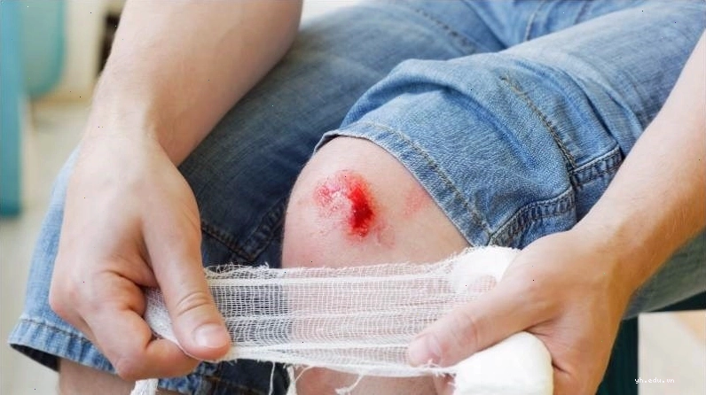 Các vết thương hở làm tăng nguy cơ nhiễm trùng da