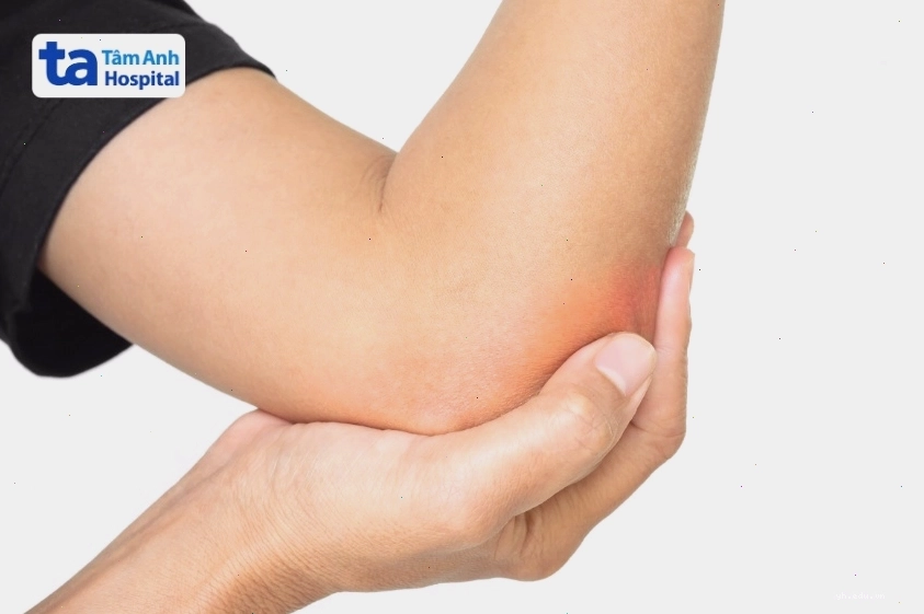 Các vùng cơ thể dễ xuất hiện cảm giác tê