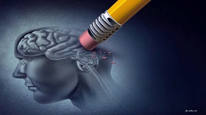 Các yếu tố nguy cơ dẫn đến Alzheimer