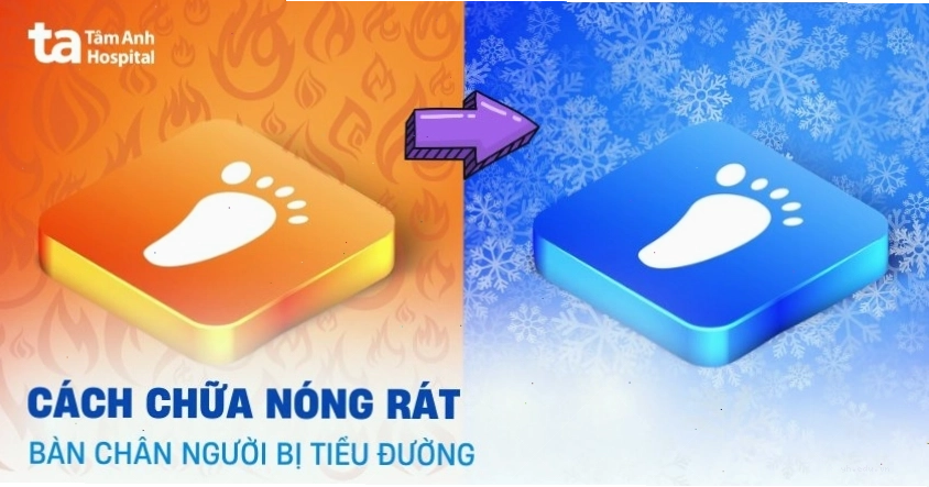 Cách chữa nóng rát bàn chân ở người tiểu đường