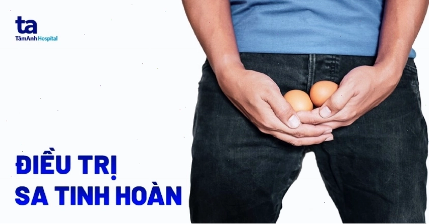 Cách điều trị sa tinh hoàn hiệu quả