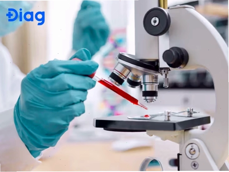 cách đọc kết quả định lượng virus viêm gan c