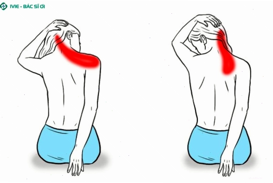Cách giãn cơ cổ vai gáy đúng cách tại nhà