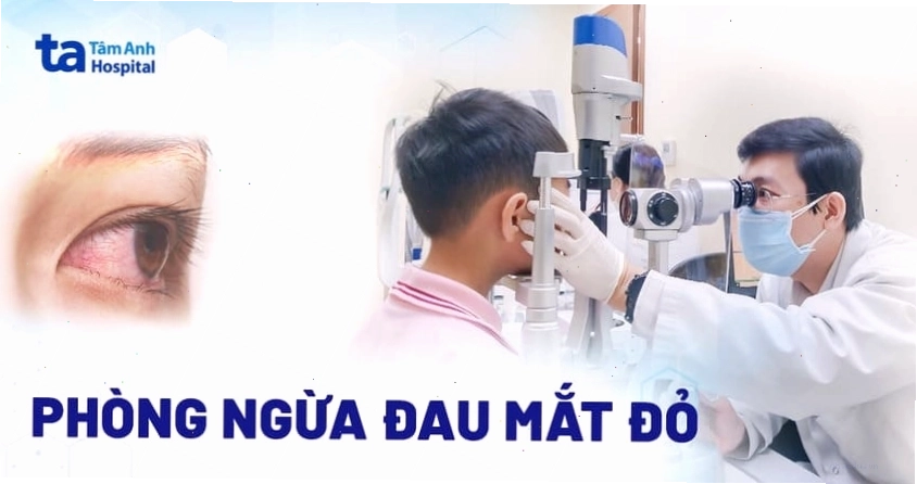Cách phòng ngừa bệnh đau mắt đỏ