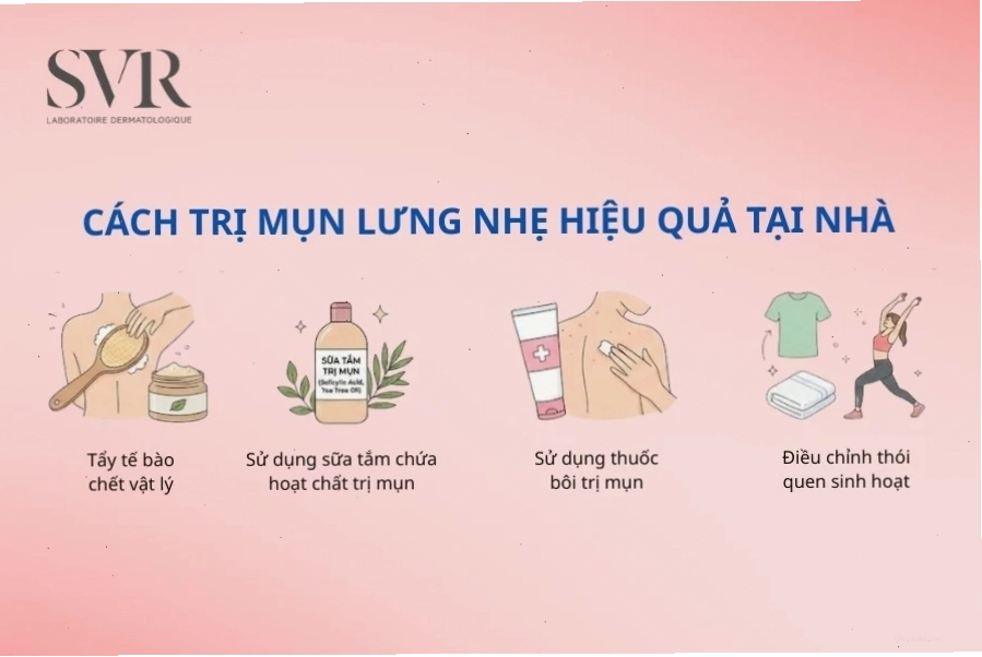 Cách trị mụn lưng tại nhà