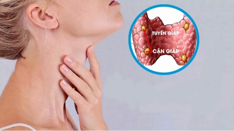 Cách xử lý khát nước liên tục