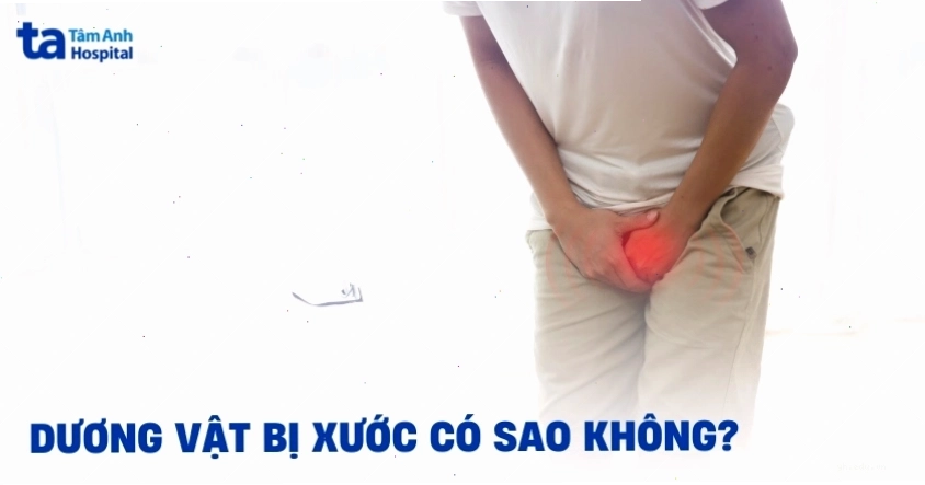 Cách xử lý khi dương vật bị xước do ma sát