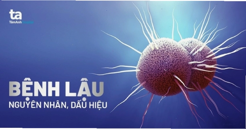 Cận cảnh hình ảnh bệnh lậu