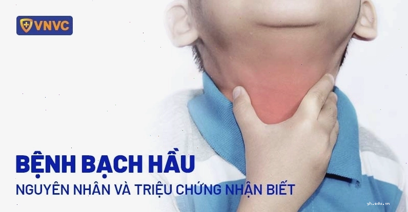 Cận cảnh mô phỏng bệnh bạch hầu
