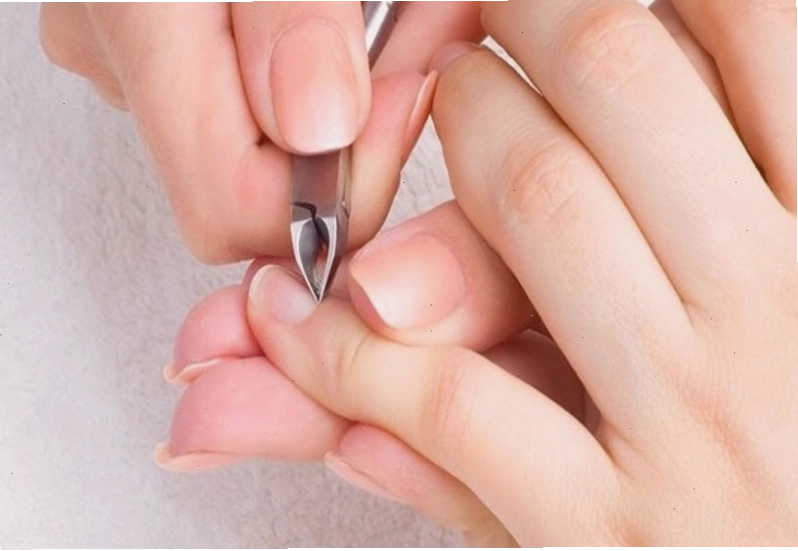 Cắt móng quá sâu làm tăng nguy cơ bị bệnh