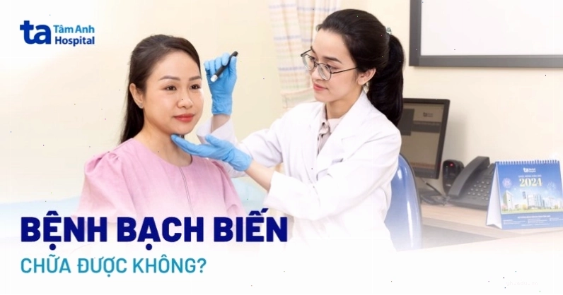 Câu hỏi về khả năng chữa trị bệnh bạch biến