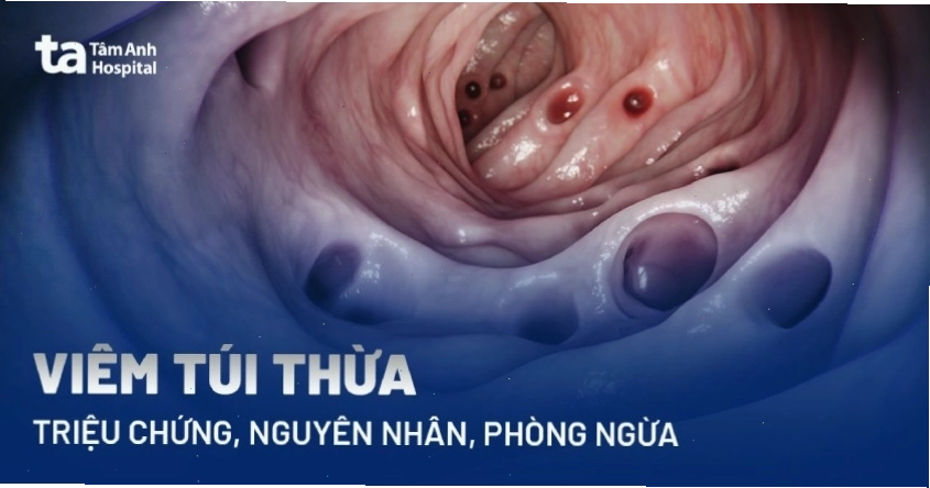 Cấu trúc bệnh lý của túi thừa