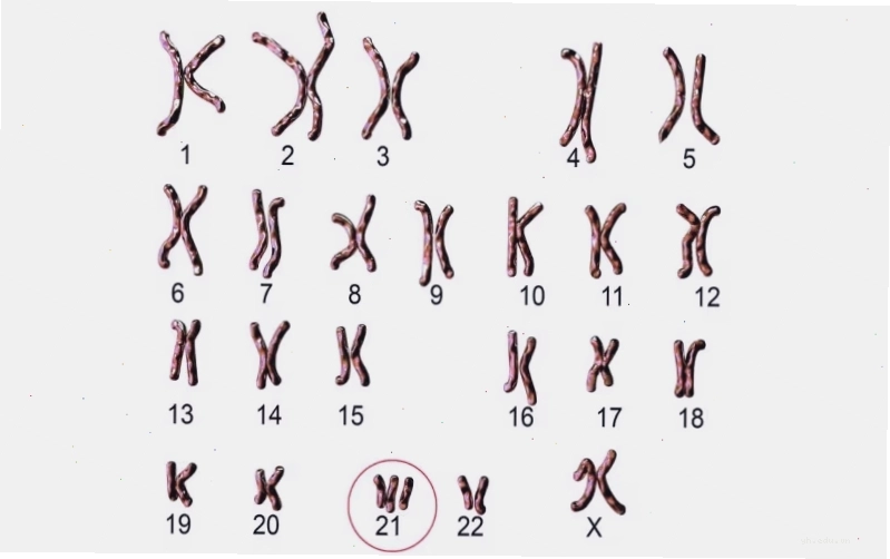 Cấu trúc nhiễm sắc thể số 22 trong tế bào