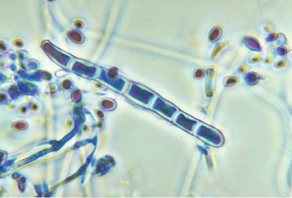 Cấu trúc vi nấm Trichophyton gây bệnh