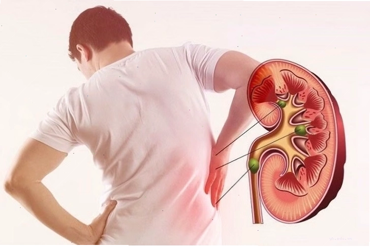 Cây cát lồi và hỗ trợ xương khớp