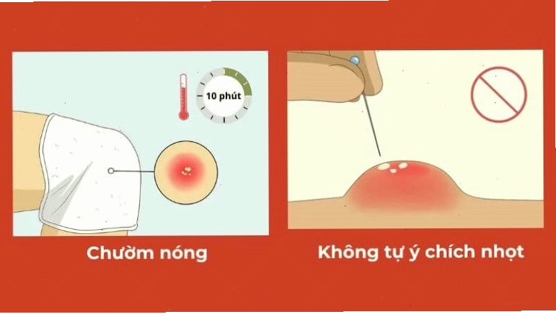 Chăm sóc da đúng cách
