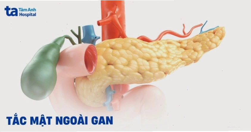 Chăm sóc sức khỏe tổng thể giúp giảm áp lực lên tim