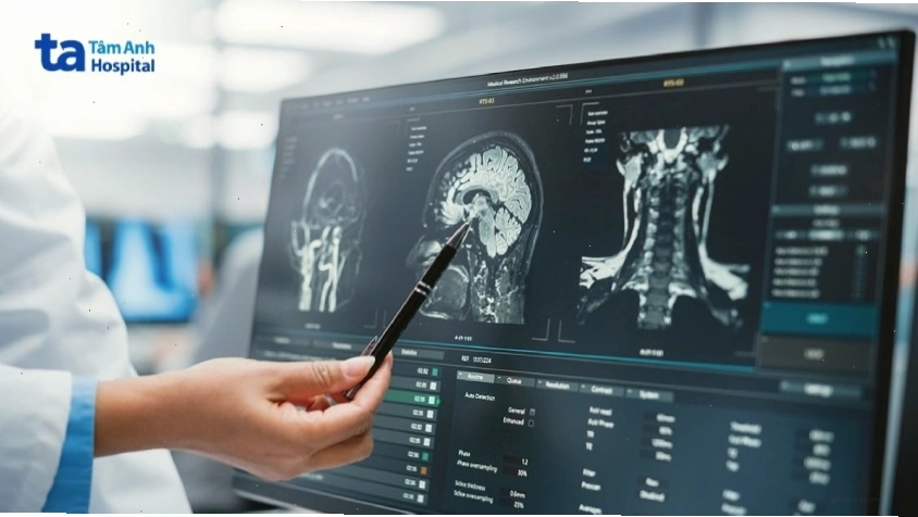 Chẩn đoán bại não bằng cộng hưởng từ