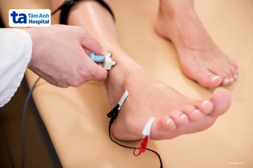 Chẩn đoán điện cơ đồ cho người bị tê chân
