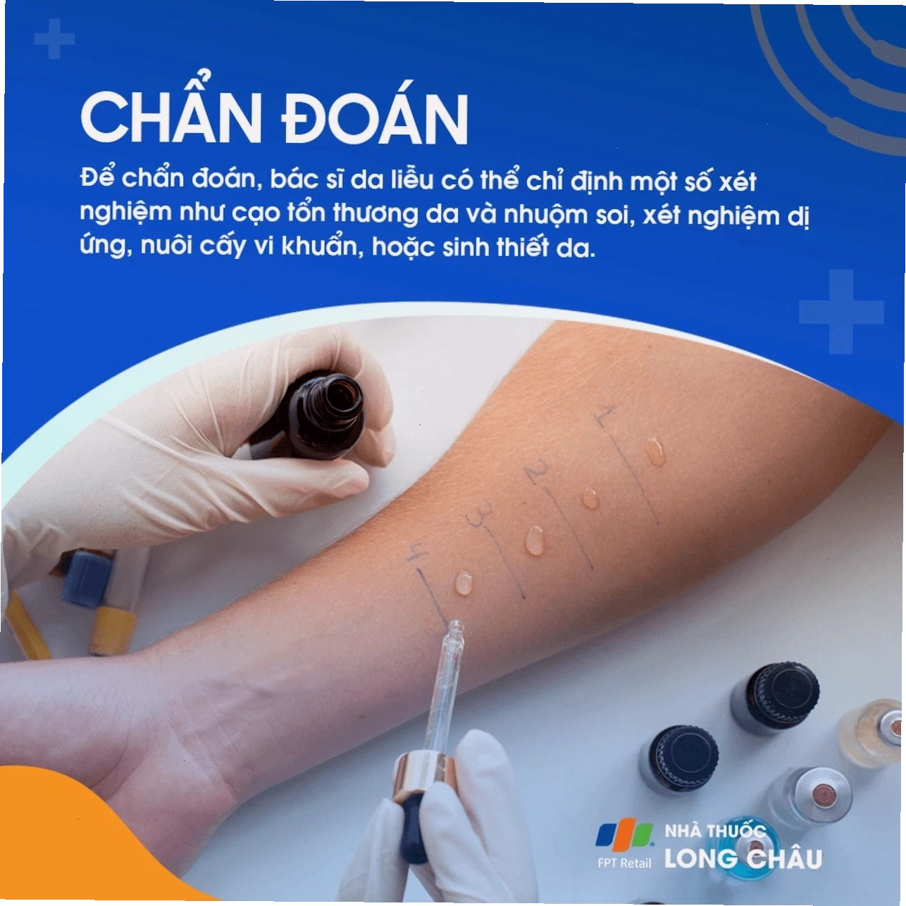Chẩn đoán y khoa bệnh chàm