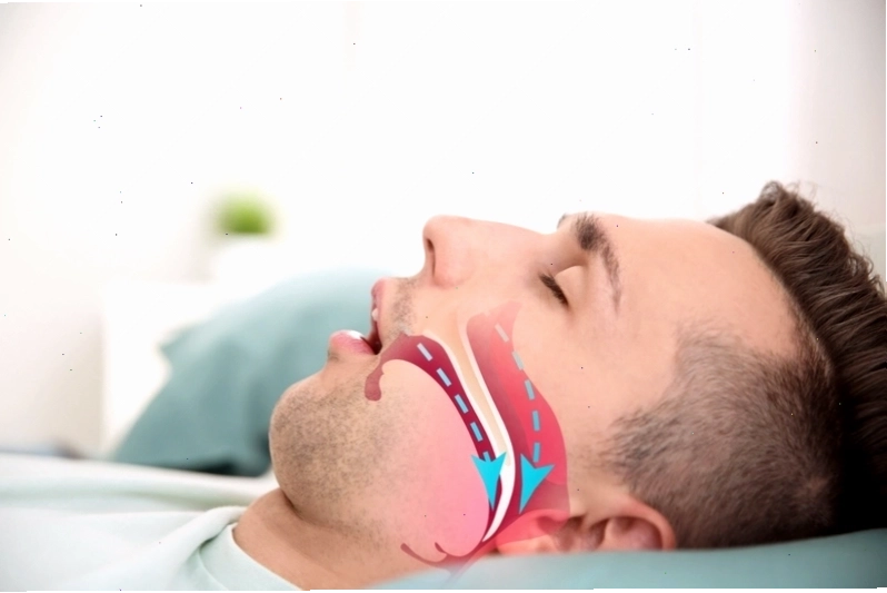 Chảy nước miếng trong khi ngủ nguyên nhân và cách khắc phục