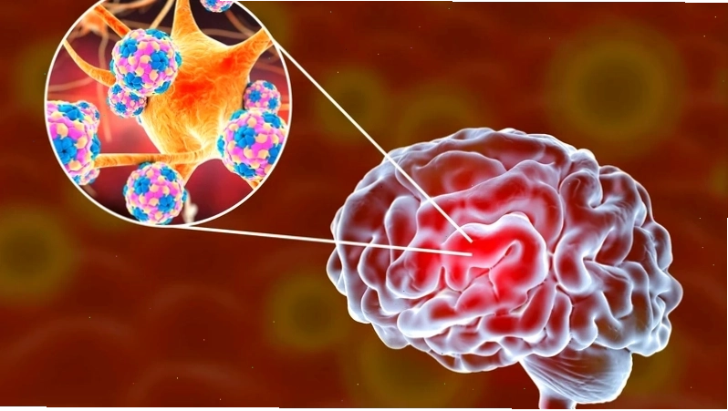 Chế độ ăn an toàn phòng tránh Listeria monocytogenes