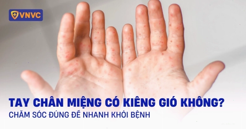 Chế độ chăm sóc và vấn đề kiêng cữ khi bị tay chân miệng