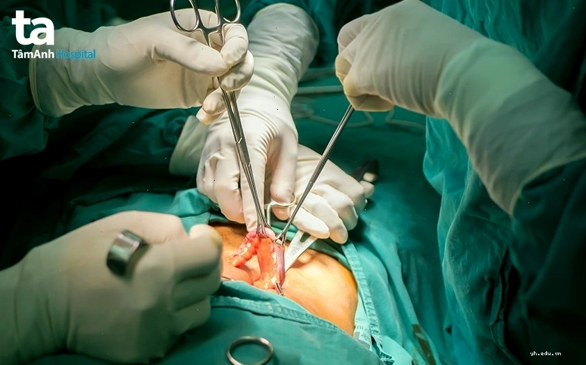 Chế độ dinh dưỡng sau phẫu thuật ruột thừa