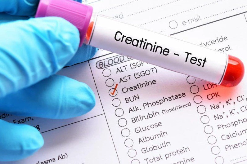 Chỉ số Creatinin giảm trong bệnh gì và những lưu ý y khoa quan trọng