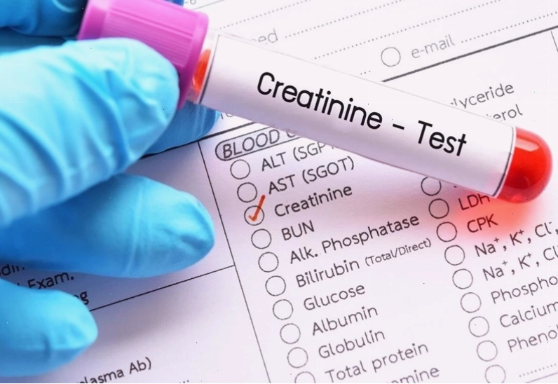 Chỉ số Creatinin giúp đánh giá chức năng thận