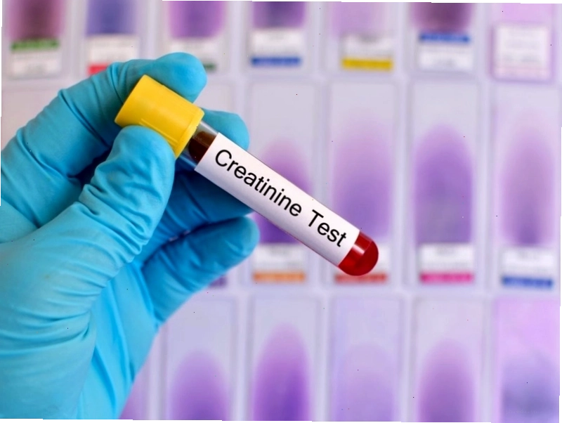 Chỉ số Creatinin thấp có sao không