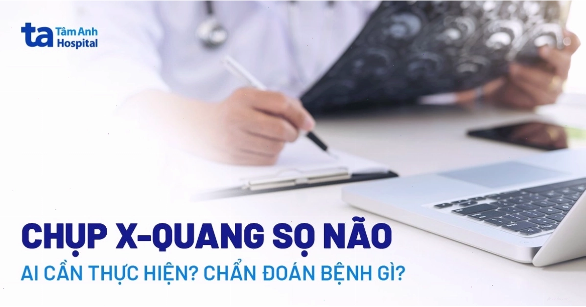 Chụp X-quang sọ não